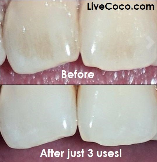 Teeth Cleaning Powder (Vitamins & Aloe Vera Infused) - REGN